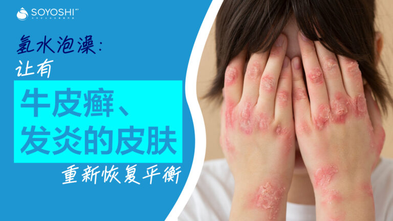 氢水泡澡：让有牛皮癣、发炎的皮肤重新恢复平衡